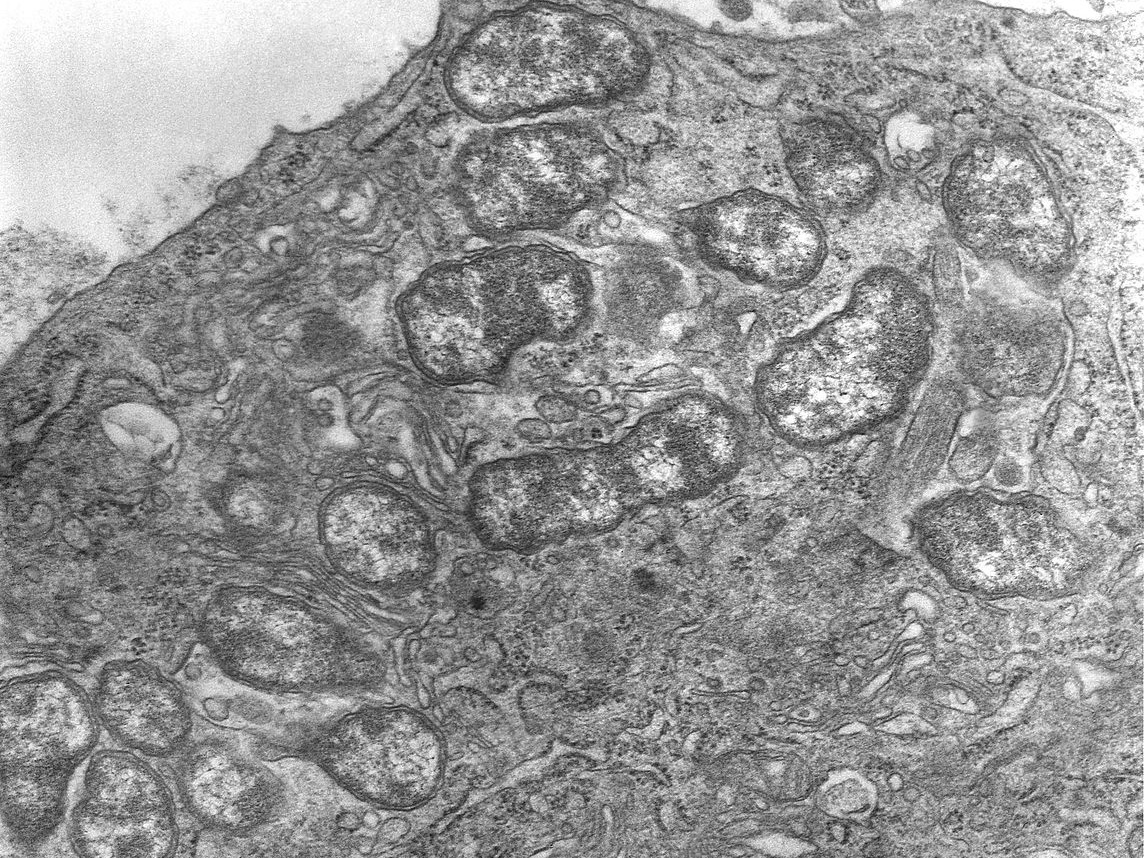 ２つの流行期を持ち毎年400～600人が罹患