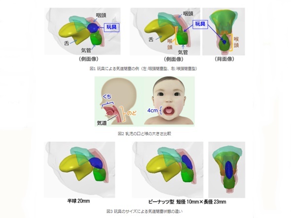 玩具飲み込みによる窒息事故を解析